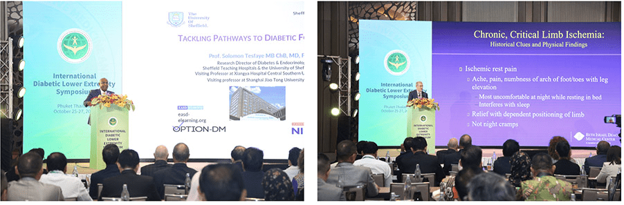 El Simposio Internacional de Extremidad Inferior Diabética 2023 se celebra en Phuket, Tailandia