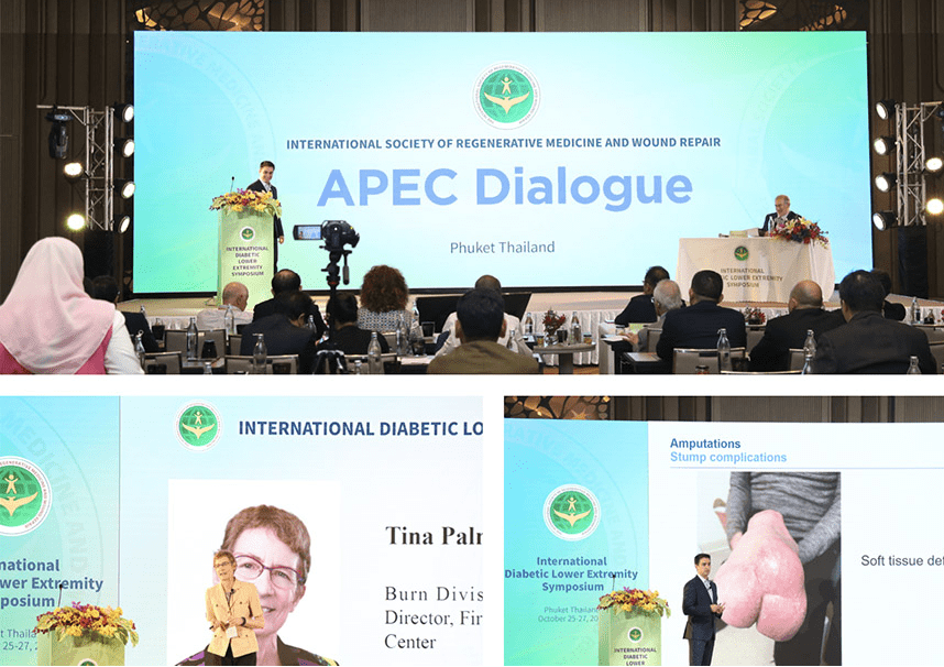El Simposio Internacional de Extremidad Inferior Diabética 2023 se celebra en Phuket, Tailandia
